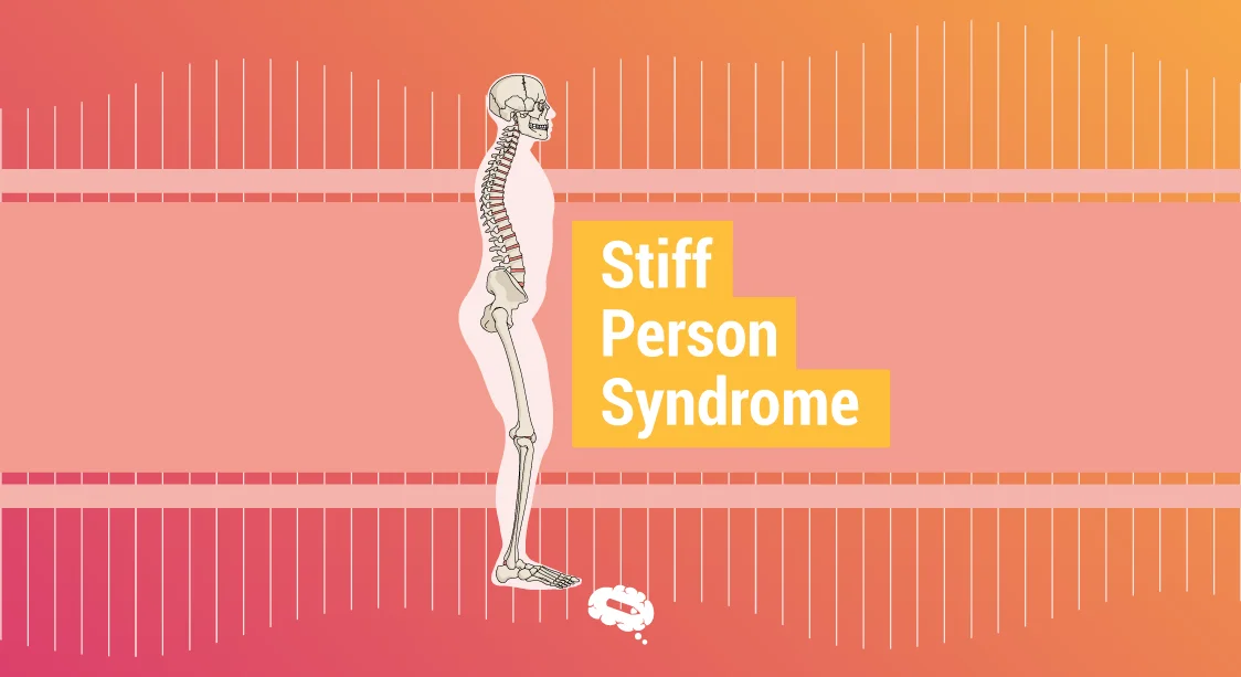 Empowering You With Knowledge: Understanding Stiff Person Syndrome And Available Treatment Options